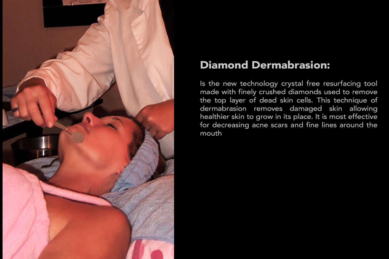 Deep dermal diamond microdermabrasion